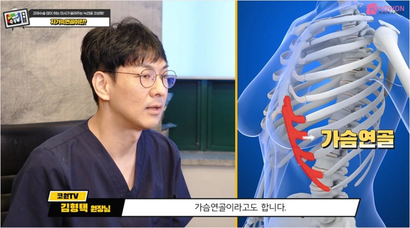 기증늑연골 장점 단점 강남코재수술 잘하는곳 사진 7
