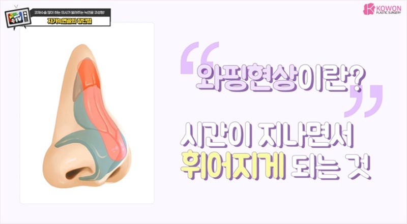 기증늑연골 장점 단점 강남코재수술 잘하는곳 사진 8