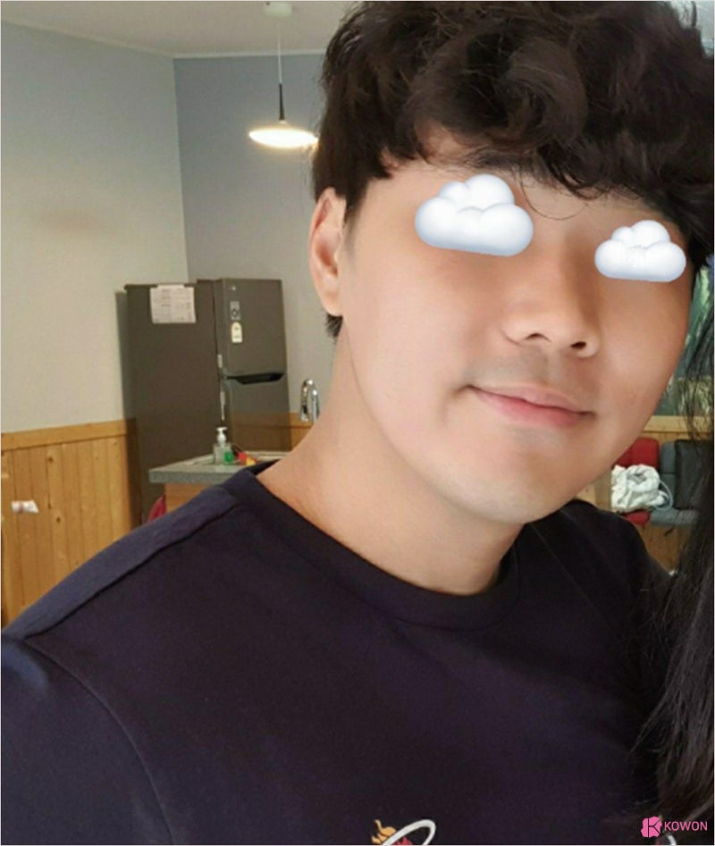 코원으로 선택하길 잘 한것 같습니다 (코원남자코성형후기)