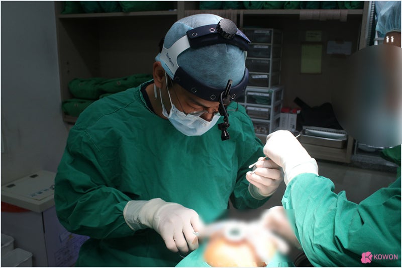 강남역성형외과 퍼진코 개선방법 사진 3