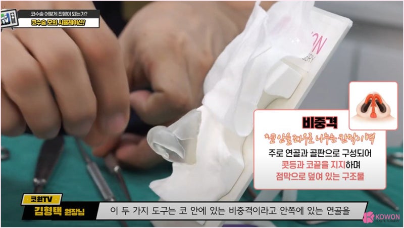 성형외과수술실 압구정코성형 진행 과정 사진 3