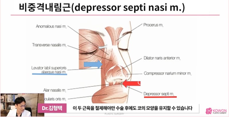 압구정성형외과 처지는 화살코수술 잘하는 곳 사진 11