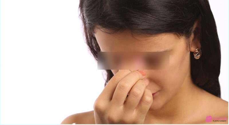 코로나 코통증 원인 코골이 코피 증상 사진 11