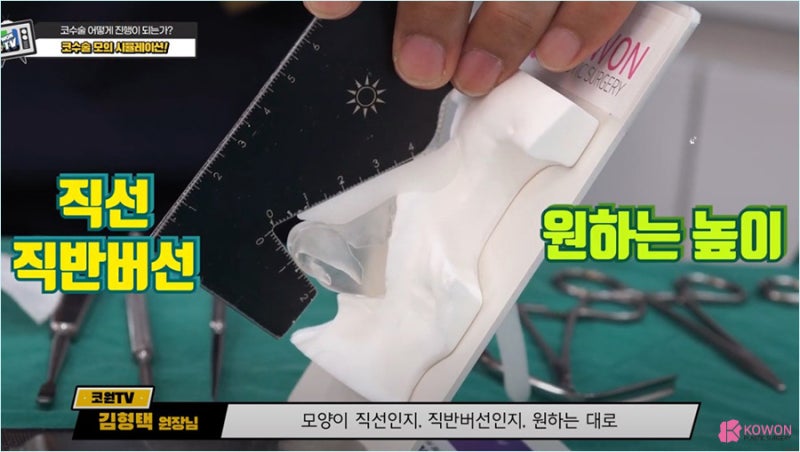 비염코성형 자신에게 잘 맞는 코성형재료 알아보기 사진 7