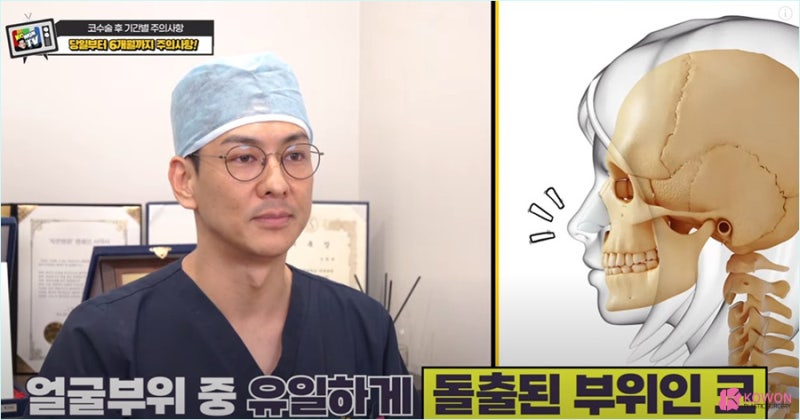 압구정코성형 언제부터 코수술후산책 가능한지 확인하기