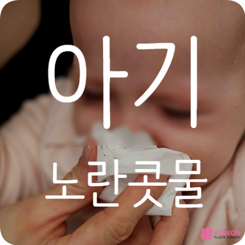 아기노란콧물 감기약 종류 실내 온습도 관리