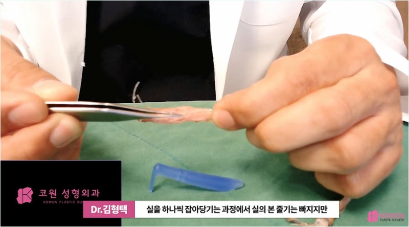 자가진피코수술 노하우로 진행한 코끝실제거 사진 12