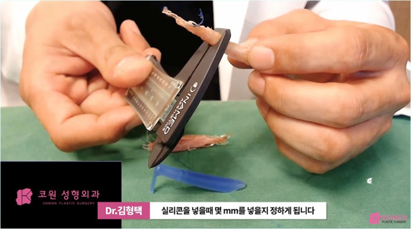 자가진피코수술 노하우로 진행한 코끝실제거 사진 13