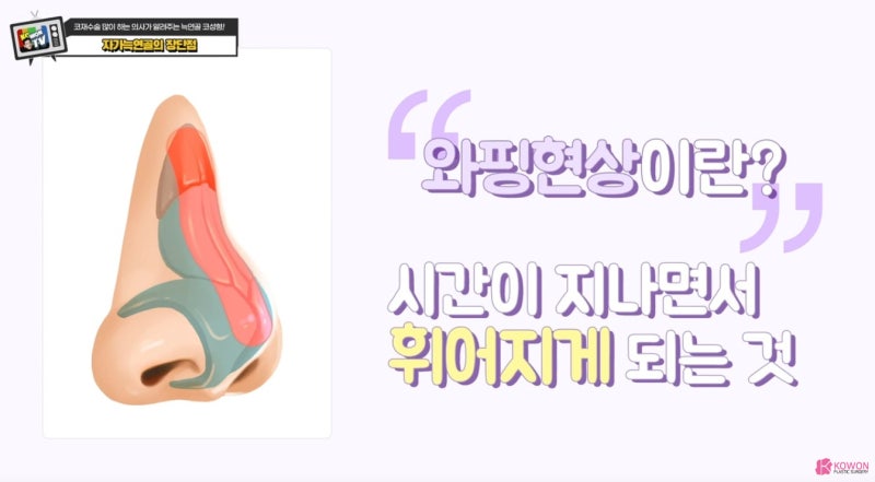 압구정코성형외과 코재수술설명 자가늑코수술 사진 13