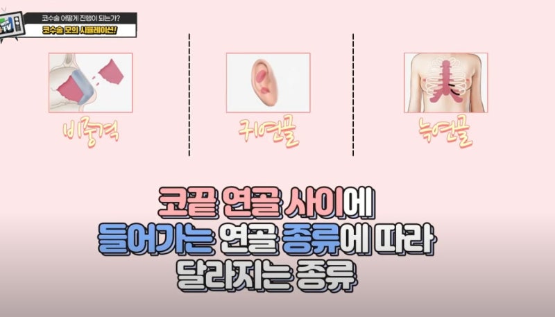 신사역코성형외과의 코성형과정 수술전 필독 사진 6