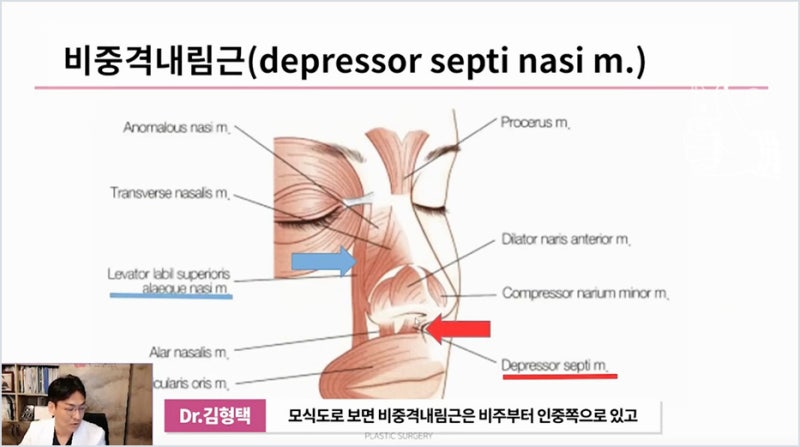 강남코성형 코수술후낮아짐 긴코 증상 원인 사진 8