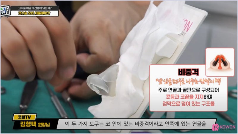 서울코수술 시뮬레이션을 통해 알아보는 코수술방법