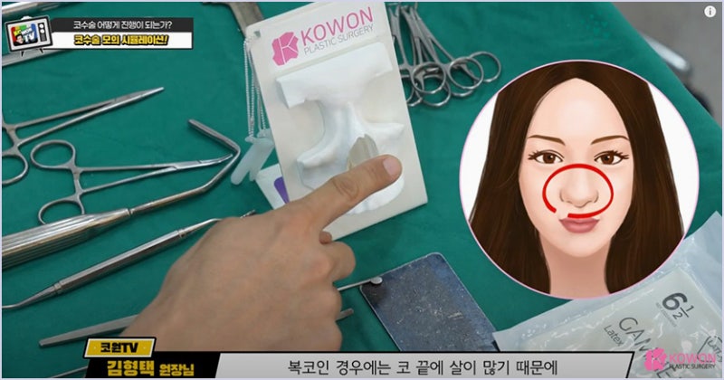 서울코수술 시뮬레이션을 통해 알아보는 코수술방법 사진 10