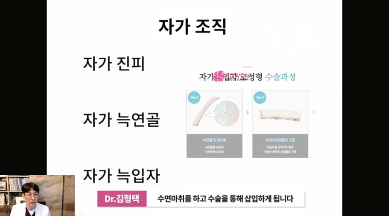 가로수성형외과 코수술후실 제거 방법 시술 사진 3