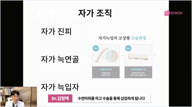 서초성형외과 미주코 방식과 한꺼번에 제거해야 하는 이유 사진 3
