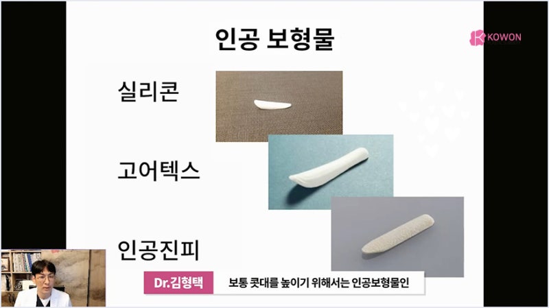 서초성형외과 미주코 방식과 한꺼번에 제거해야 하는 이유