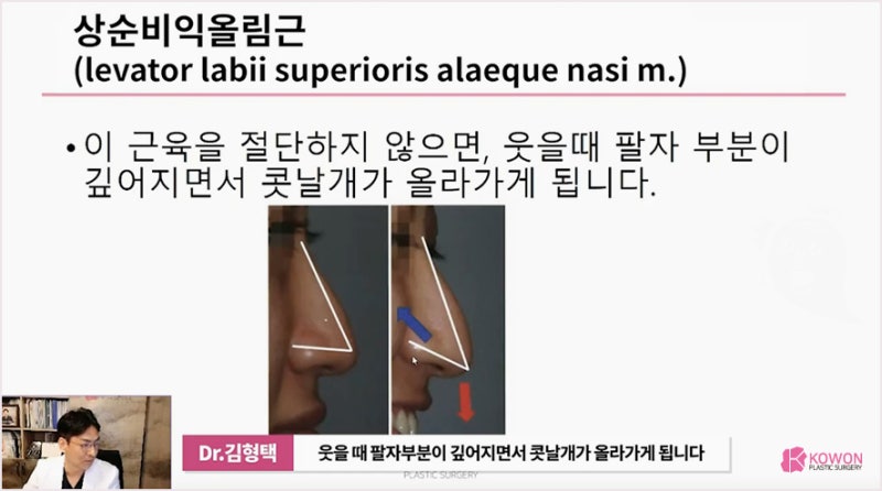 코수술전문 성형외과, 화살코 긴 코 왜 그럴까? 사진 12