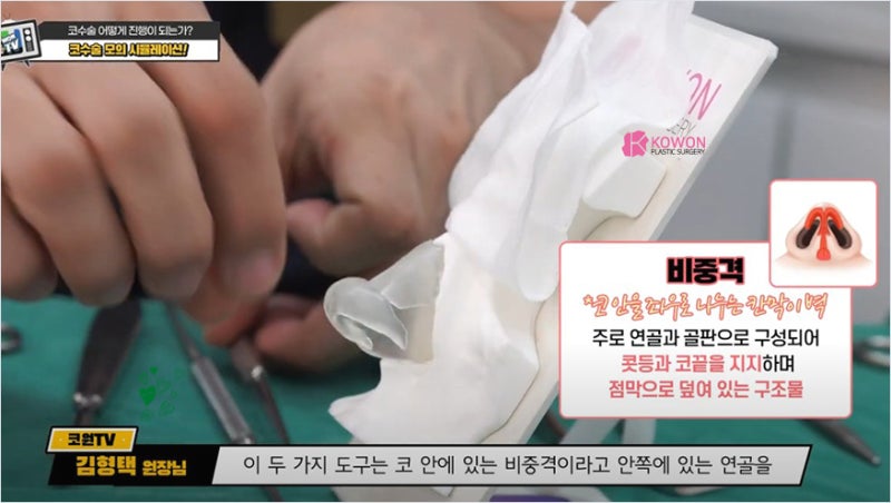 코수술유명한곳 매부리깎기 수술 시뮬레이션 과정 및 도구 사진 4
