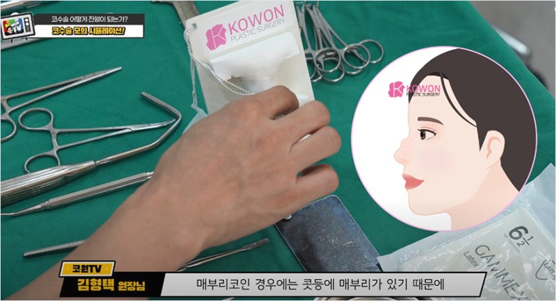코수술유명한곳 매부리깎기 수술 시뮬레이션 과정 및 도구 사진 9