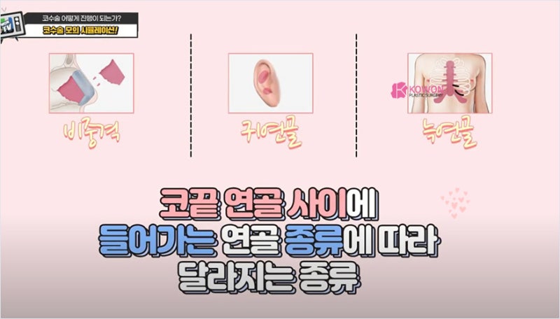 코수술유명한곳 매부리깎기 수술 시뮬레이션 과정 및 도구 사진 6