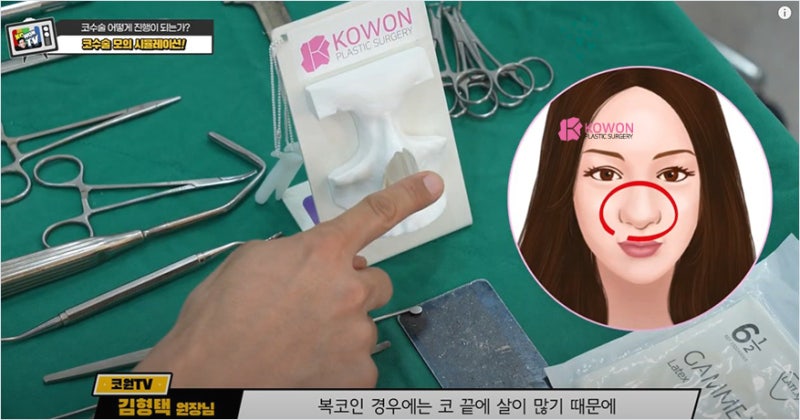 코수술유명한곳 매부리깎기 수술 시뮬레이션 과정 및 도구 사진 10