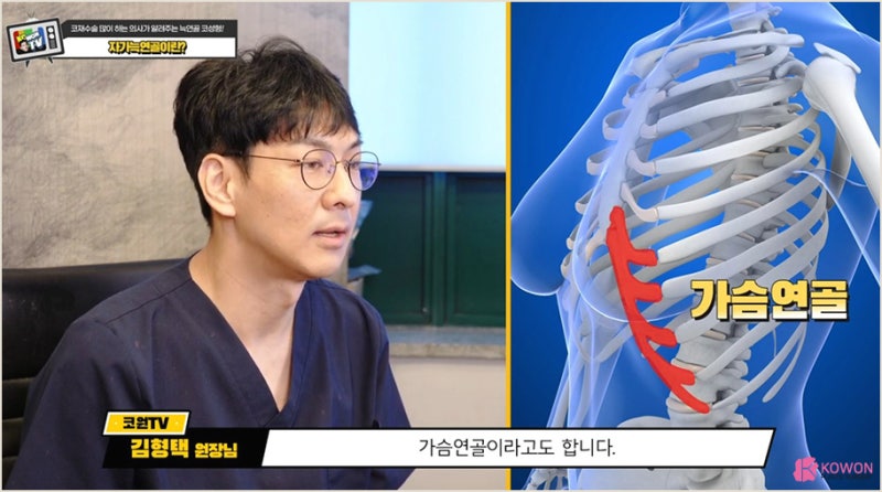 강남코성형잘하는곳 자가늑연골 심층 분석 사진 7