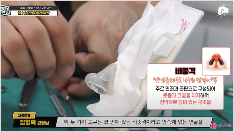 코수술유명한곳 매부리깎기 비중격 성형 전문병원 사진 4