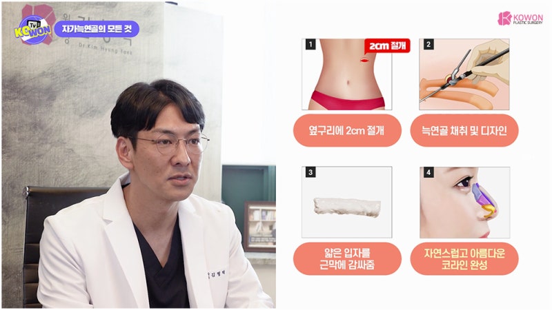 코전문성형외과 가슴연골코성형 부작용 장단점 사진 13
