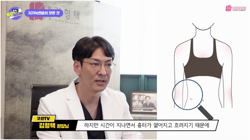 코전문성형외과 가슴연골코성형 부작용 장단점 사진 9
