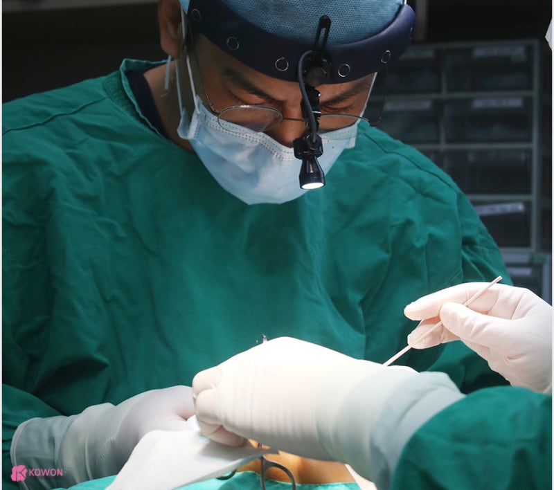 신사역성형외과 남자매부리코수술 연골 묶기 전후 사진 8