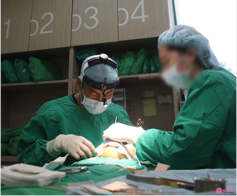 비순각수술 코패임 코재수술 고민 해결 방법 사진 3