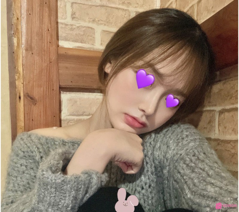 코필러후코성형 코원에서 재수술 화살코성형후기 사진 9