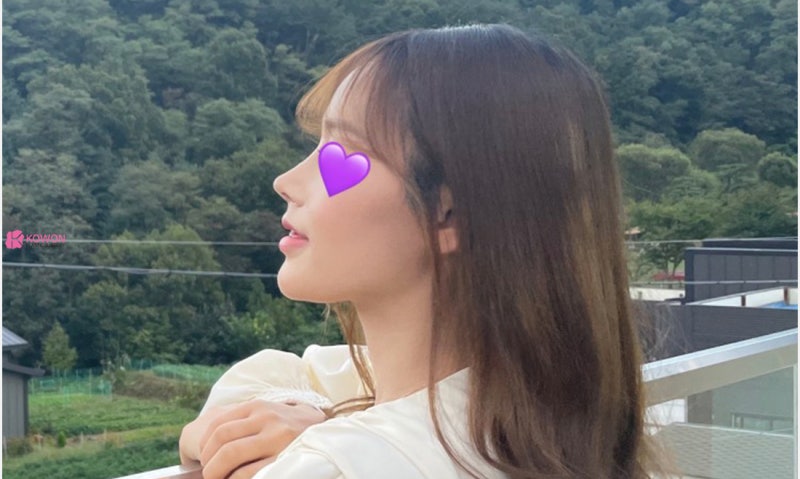 화살코관상 느낌 세련된코 수술로 이미지 개선 후기 사진 7