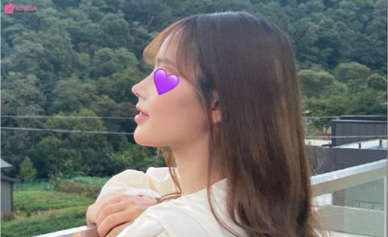 신사코수술 전후 사진으로 보는 필러후코수술 여부 사진 8