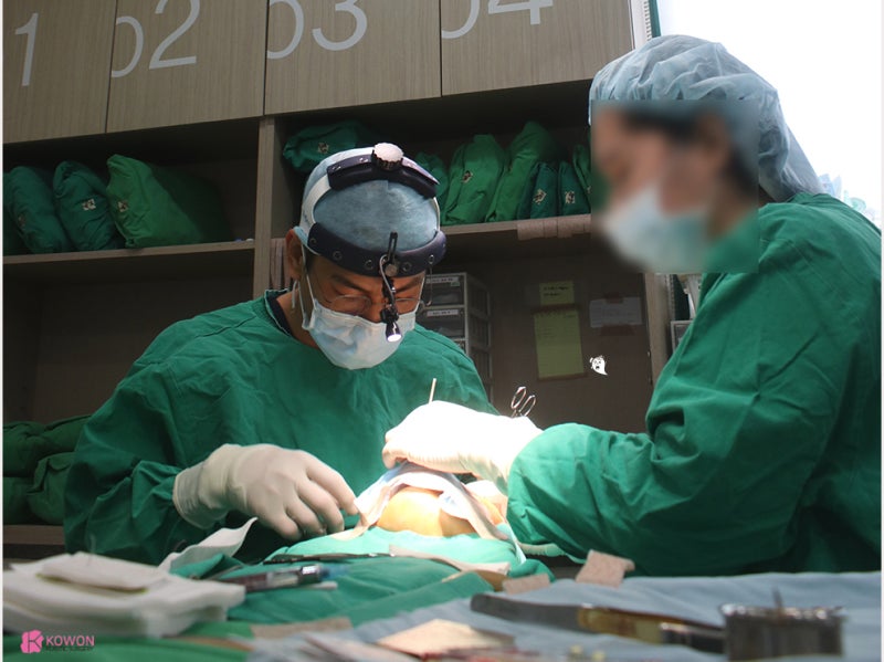 강남코재수술 전문 비대칭 개선된 자가늑코성형 사진 3