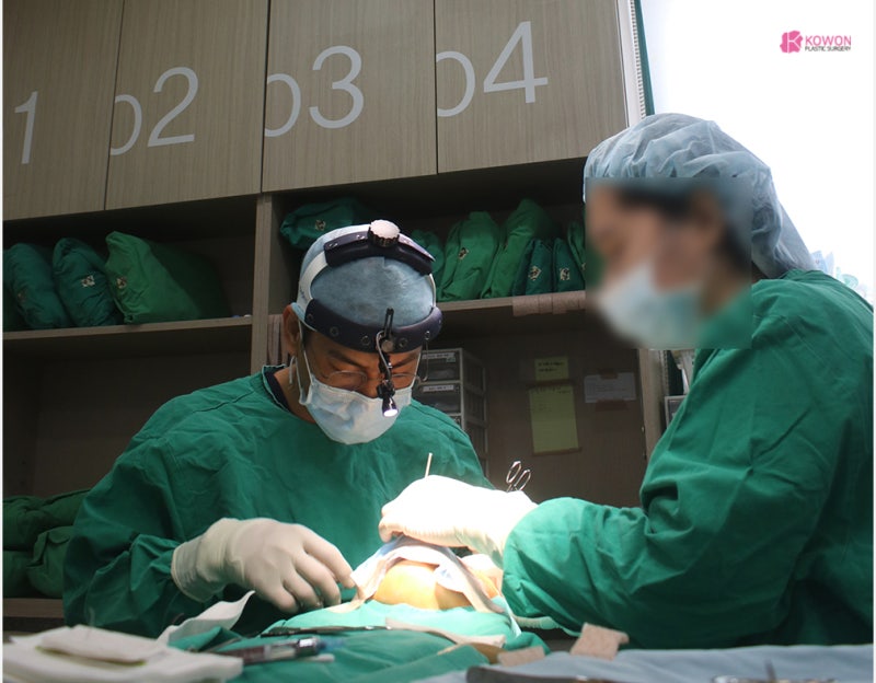 자가늑코수술 방법 두 번의 코재성형 사례 사진 3