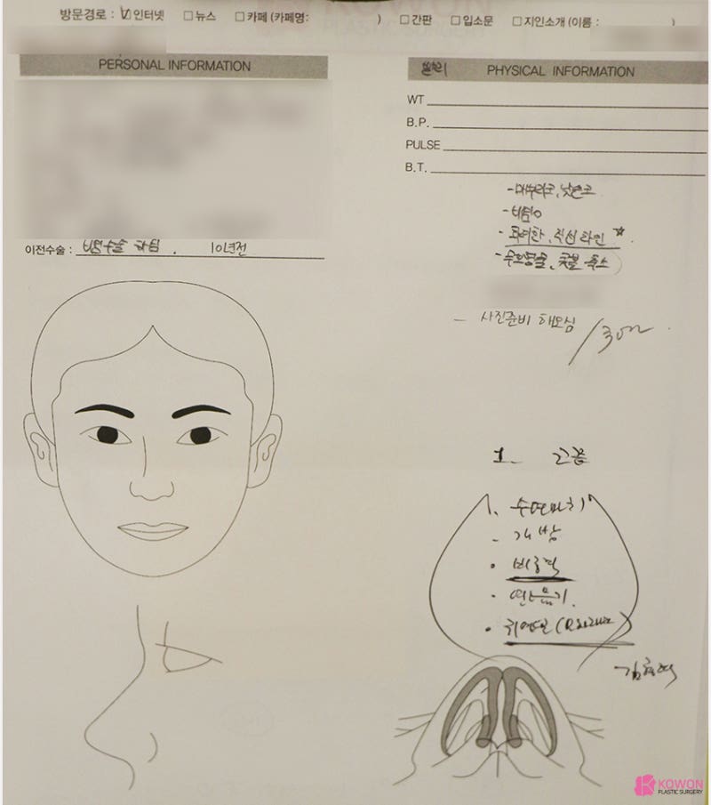 코재성형 잘하는 곳 남자직선코 수술 후기
