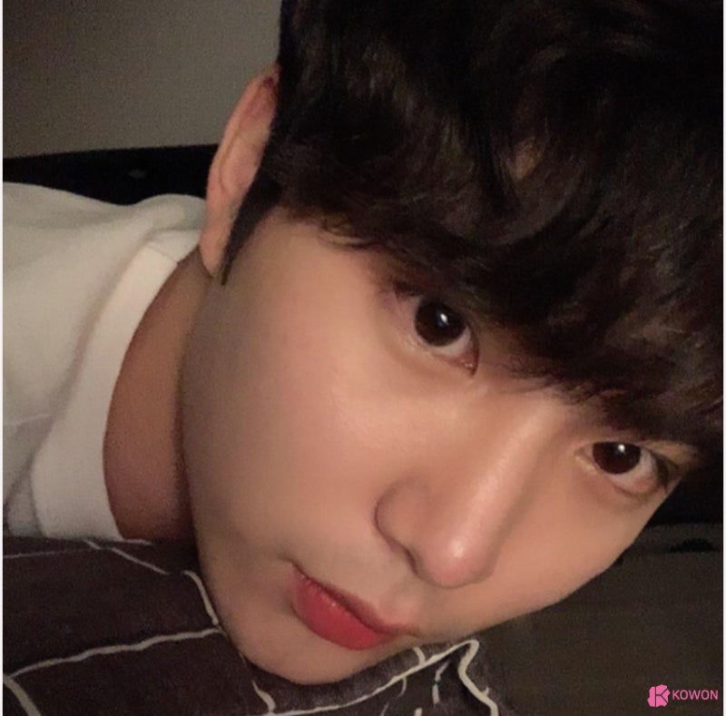 코재성형 잘하는 곳 남자직선코 수술 후기 사진 7