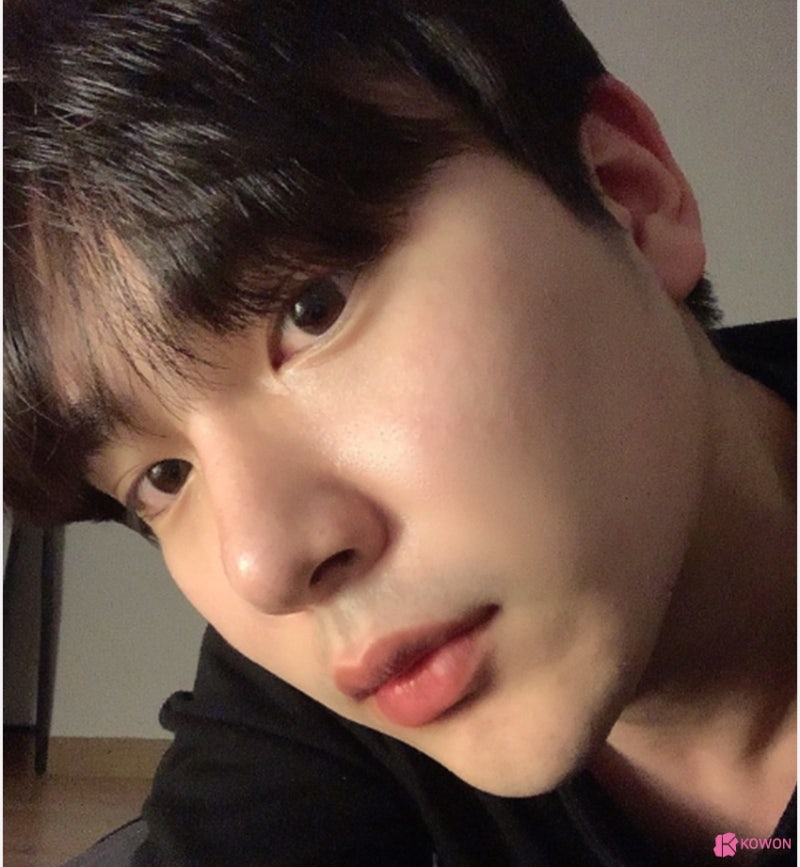 코재성형 잘하는 곳 남자직선코 수술 후기 사진 10