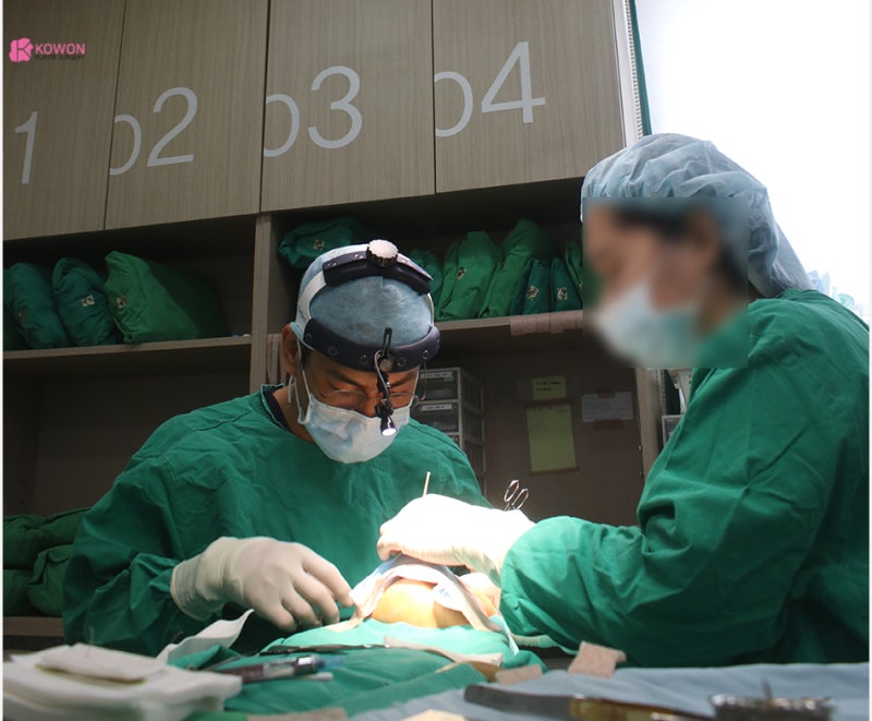 코성형잘하는곳추천 자가늑을 이용한 콧등수술 사진 3