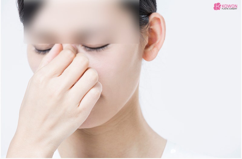 신사역성형외과 코성형비중격만곡증 만족스러운 결과 사진 4