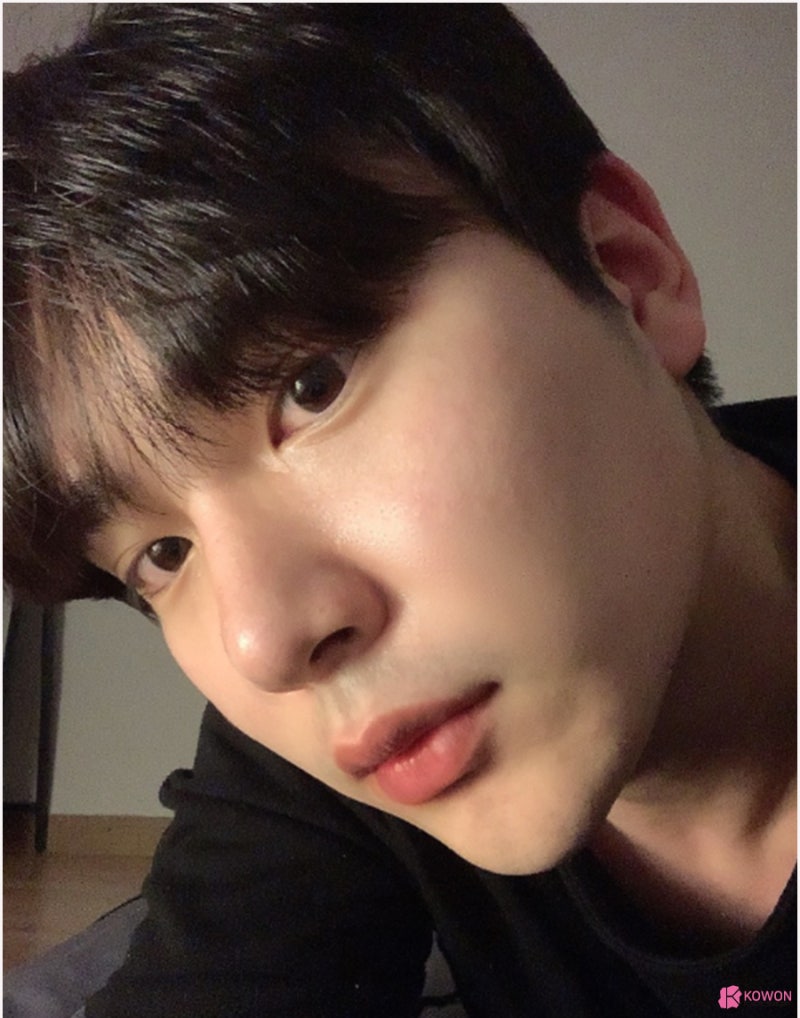 코성형전후 남성적인 코로 바뀐 매부리코교정술 방법 사진 10
