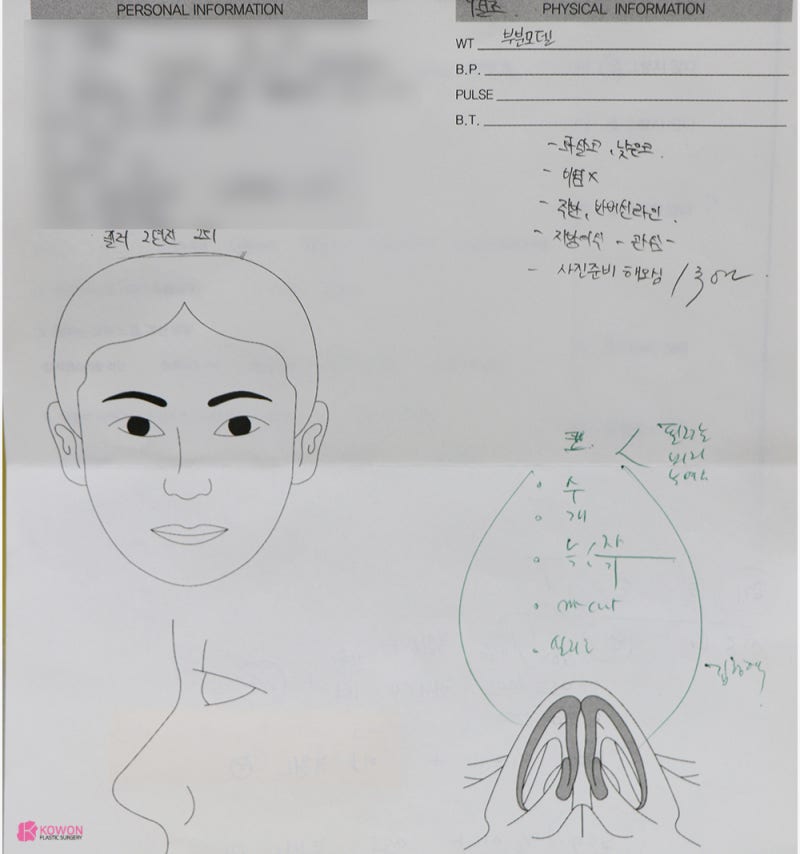 여자코성형 전문 낮은콧대 탈출한 연예인 수술 방법