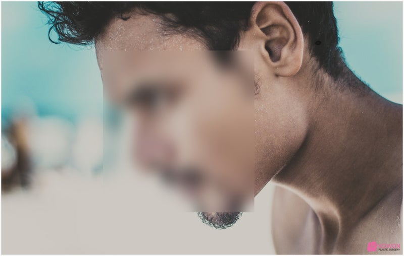 얼굴점위치 따른 관상 및 의미 생기는 이유 사진 8