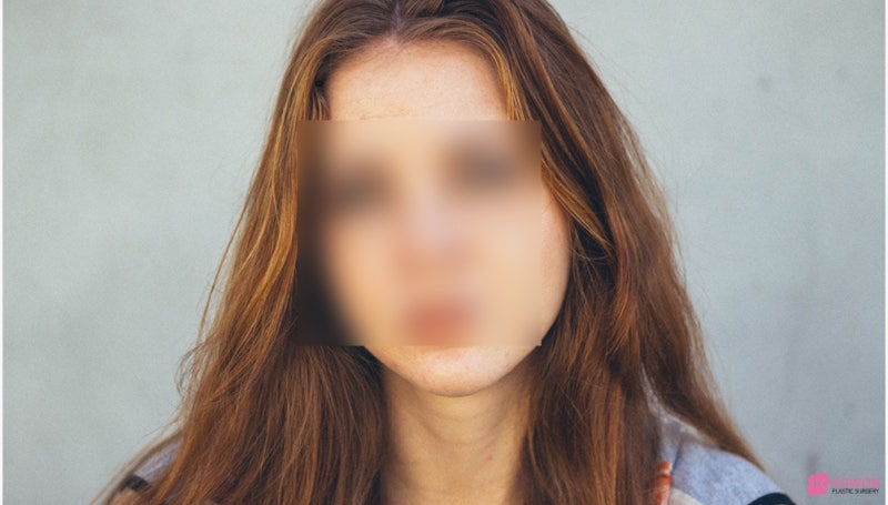 얼굴점위치 따른 관상 및 의미 생기는 이유
