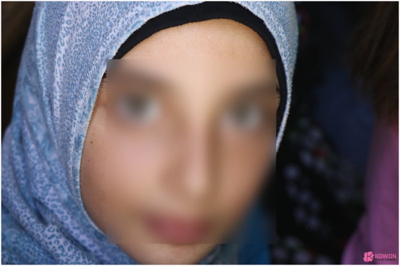 얼굴점위치 따른 관상 및 의미 생기는 이유 사진 5