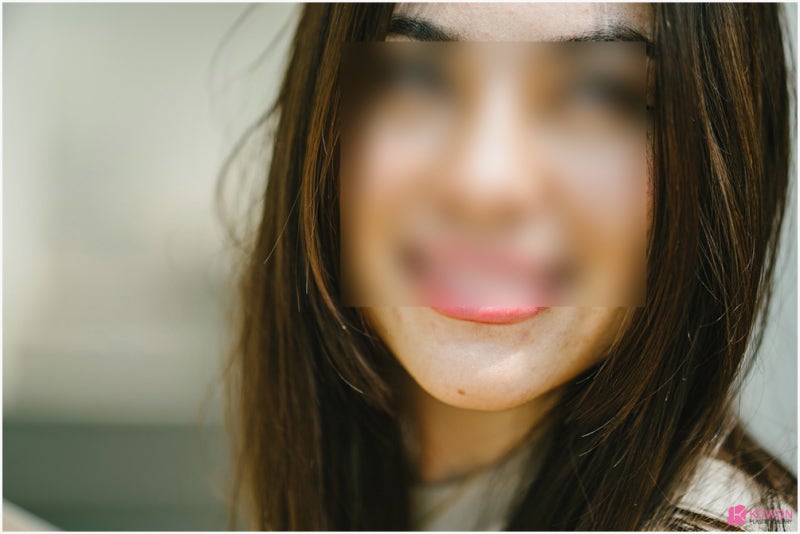 얼굴점위치 따른 관상 및 의미 생기는 이유 사진 10