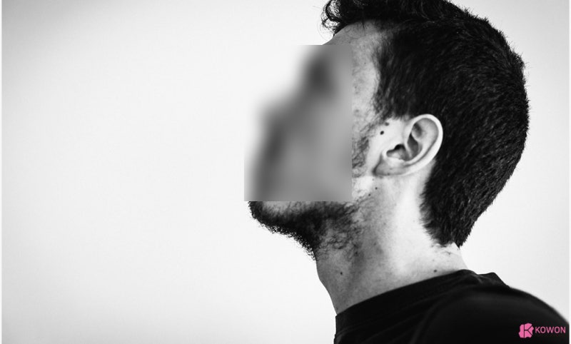 얼굴점위치 따른 관상 및 의미 생기는 이유 사진 9