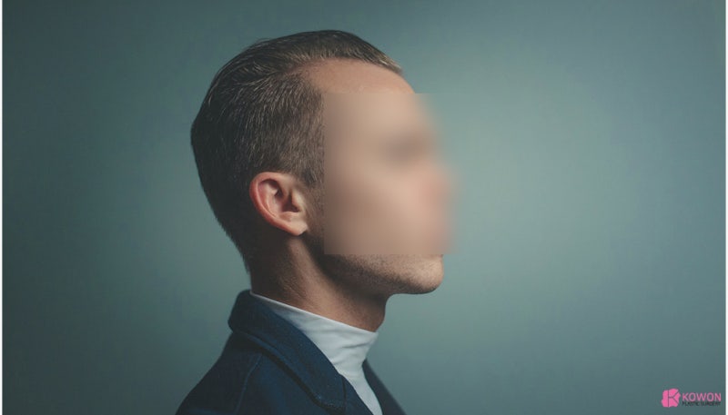 얼굴점위치 따른 관상 및 의미 생기는 이유 사진 2