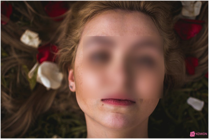 얼굴점위치 따른 관상 및 의미 생기는 이유 사진 4